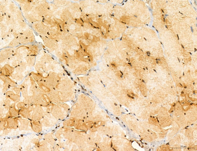 TELO2 Antibody in Immunohistochemistry (Paraffin) (IHC (P))