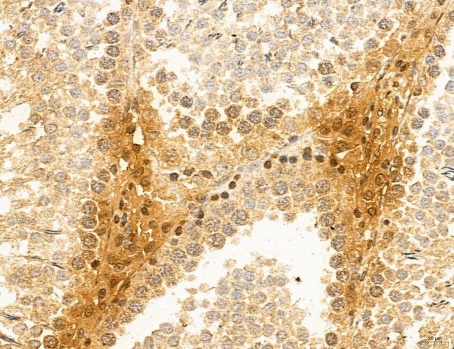 TELO2 Antibody in Immunohistochemistry (Paraffin) (IHC (P))