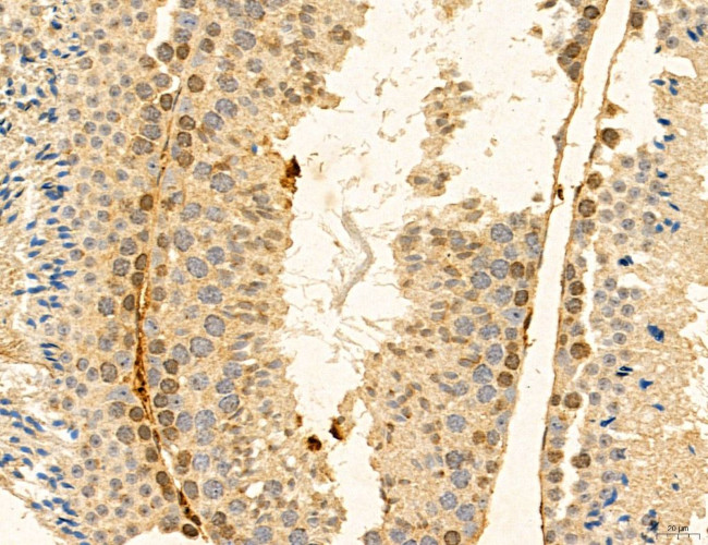 TELO2 Antibody in Immunohistochemistry (Paraffin) (IHC (P))