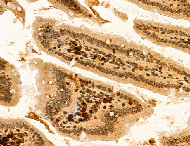 TELO2 Antibody in Immunohistochemistry (Paraffin) (IHC (P))