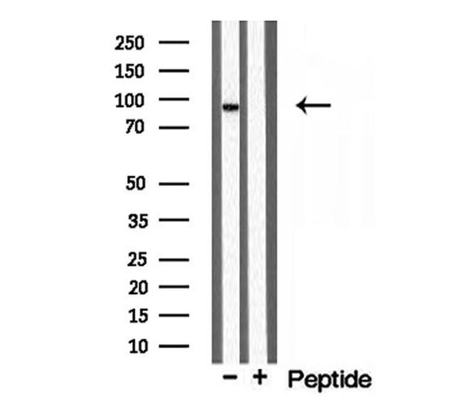 TELO2 Antibody in Western Blot (WB)