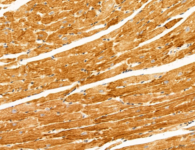 UGT2B7 Antibody in Immunohistochemistry (Paraffin) (IHC (P))