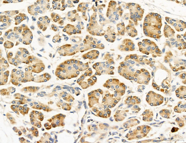 UGT2B7 Antibody in Immunohistochemistry (Paraffin) (IHC (P))