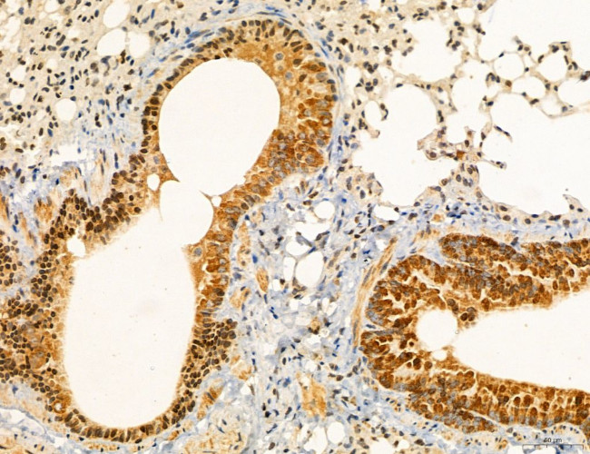 UGT2B7 Antibody in Immunohistochemistry (Paraffin) (IHC (P))