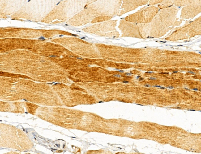 UGT2B7 Antibody in Immunohistochemistry (Paraffin) (IHC (P))