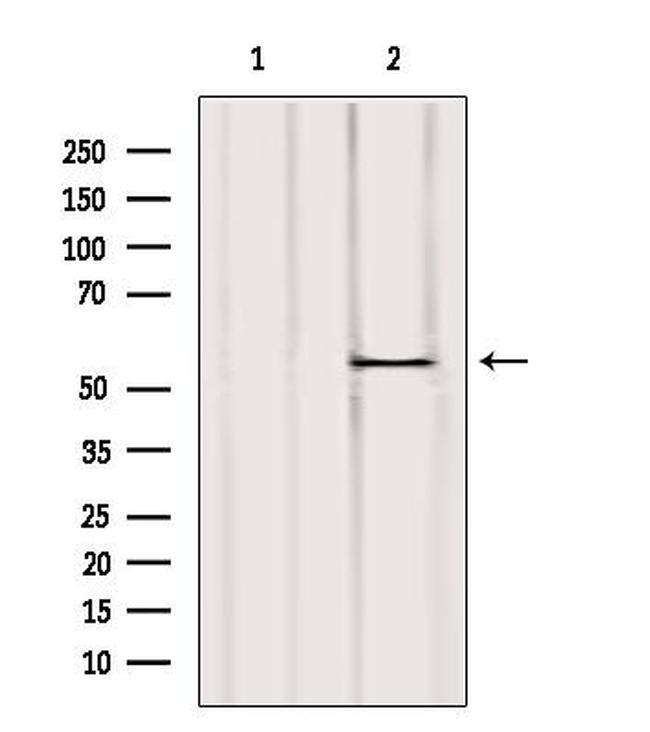 UGT2B7 Antibody in Western Blot (WB)