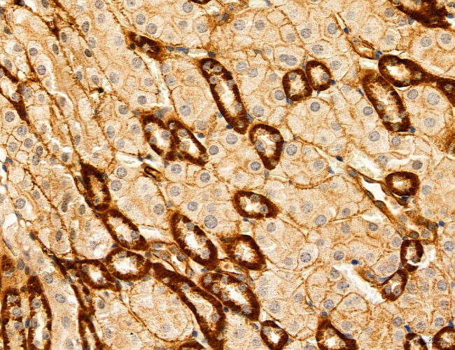 ACSL4 Antibody in Immunohistochemistry (Paraffin) (IHC (P))