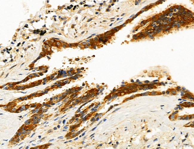 ACSL4 Antibody in Immunohistochemistry (Paraffin) (IHC (P))