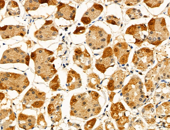 ACSL4 Antibody in Immunohistochemistry (Paraffin) (IHC (P))