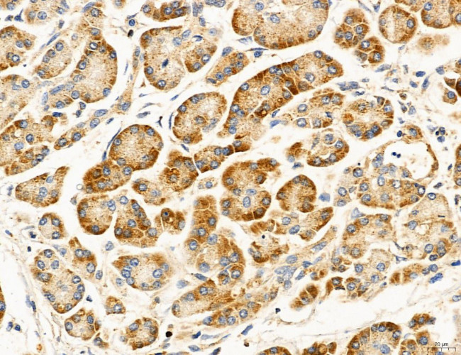 ACSL4 Antibody in Immunohistochemistry (Paraffin) (IHC (P))