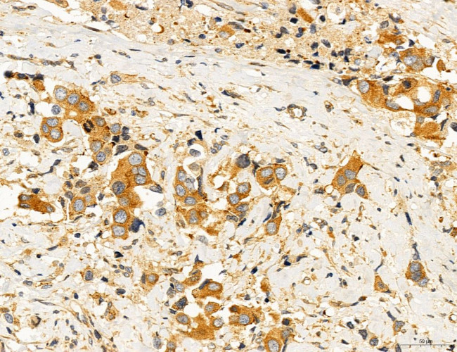 ACSL4 Antibody in Immunohistochemistry (Paraffin) (IHC (P))