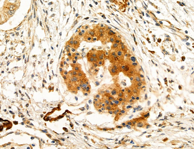 CAPZA1 Antibody in Immunohistochemistry (Paraffin) (IHC (P))