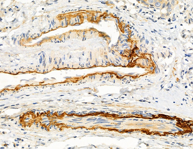 CAPZA1 Antibody in Immunohistochemistry (Paraffin) (IHC (P))