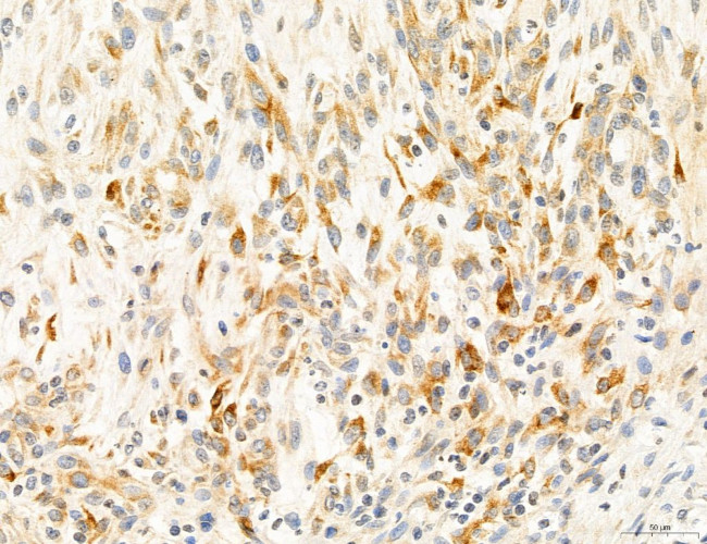 CAPZA1 Antibody in Immunohistochemistry (Paraffin) (IHC (P))