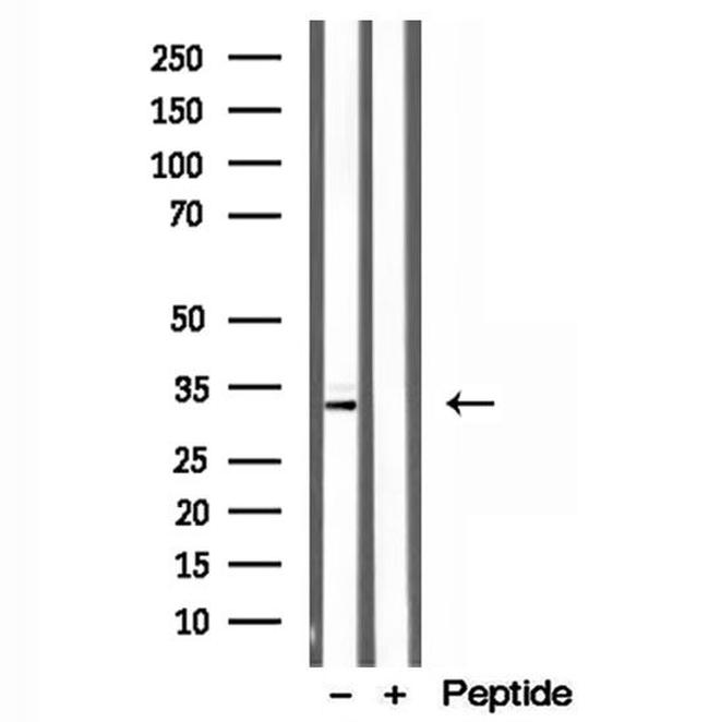 CAPZA1 Antibody in Western Blot (WB)