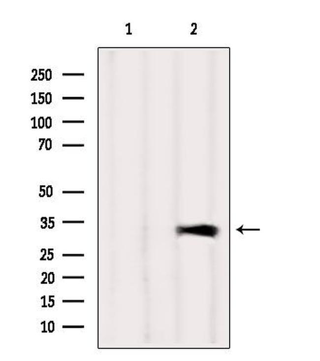 CAPZA1 Antibody in Western Blot (WB)