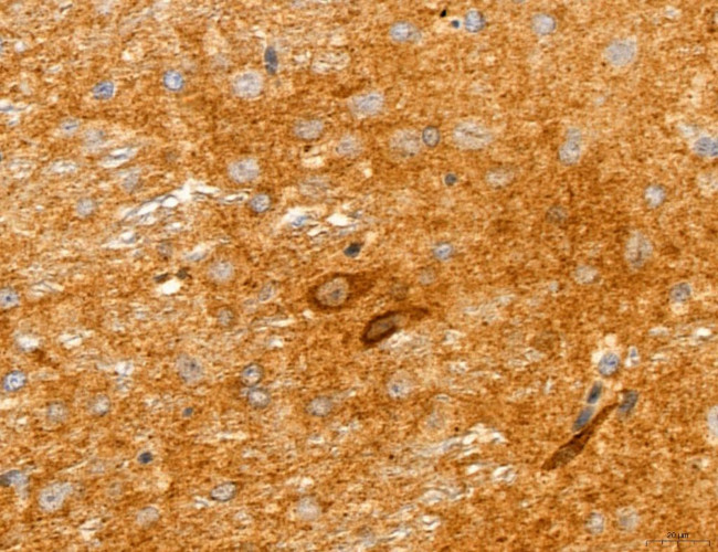 Clathrin Light Chain Antibody in Immunohistochemistry (Paraffin) (IHC (P))