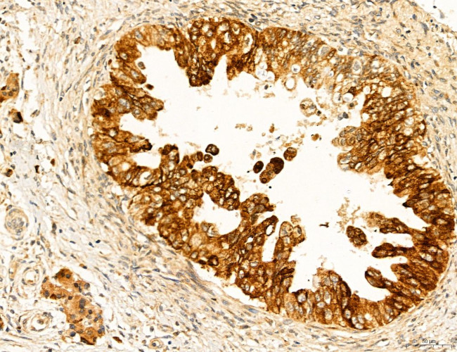 Clathrin Light Chain Antibody in Immunohistochemistry (Paraffin) (IHC (P))