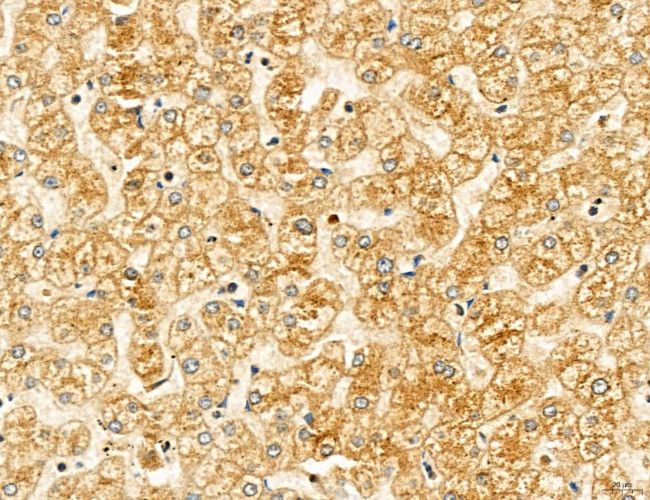 Clathrin Light Chain Antibody in Immunohistochemistry (Paraffin) (IHC (P))