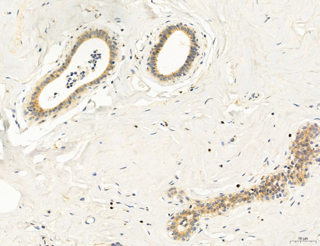 Clathrin Light Chain Antibody in Immunohistochemistry (Paraffin) (IHC (P))