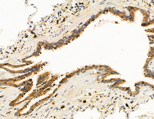 Clathrin Light Chain Antibody in Immunohistochemistry (Paraffin) (IHC (P))