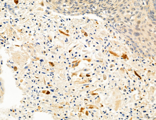 Clathrin Light Chain Antibody in Immunohistochemistry (Paraffin) (IHC (P))