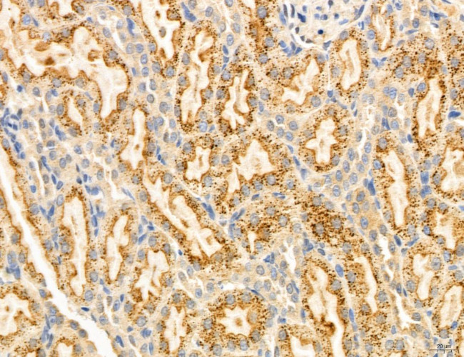 Clathrin Light Chain Antibody in Immunohistochemistry (Paraffin) (IHC (P))