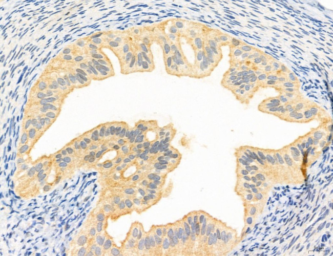 Clathrin Light Chain Antibody in Immunohistochemistry (Paraffin) (IHC (P))