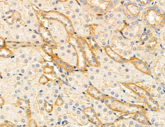 Clathrin Light Chain Antibody in Immunohistochemistry (Paraffin) (IHC (P))