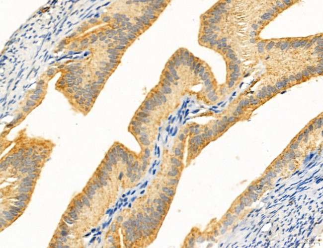 Clathrin Light Chain Antibody in Immunohistochemistry (Paraffin) (IHC (P))