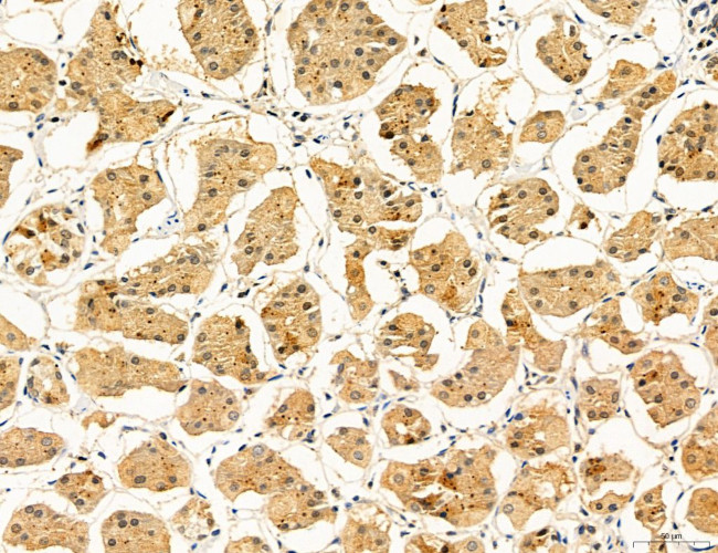 Clathrin Light Chain Antibody in Immunohistochemistry (Paraffin) (IHC (P))