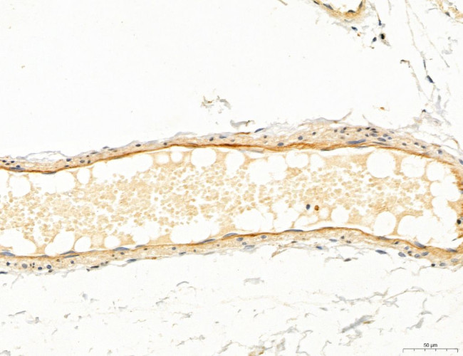 Clathrin Light Chain Antibody in Immunohistochemistry (Paraffin) (IHC (P))