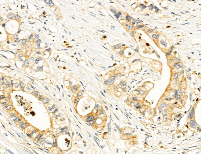 Clathrin Light Chain Antibody in Immunohistochemistry (Paraffin) (IHC (P))