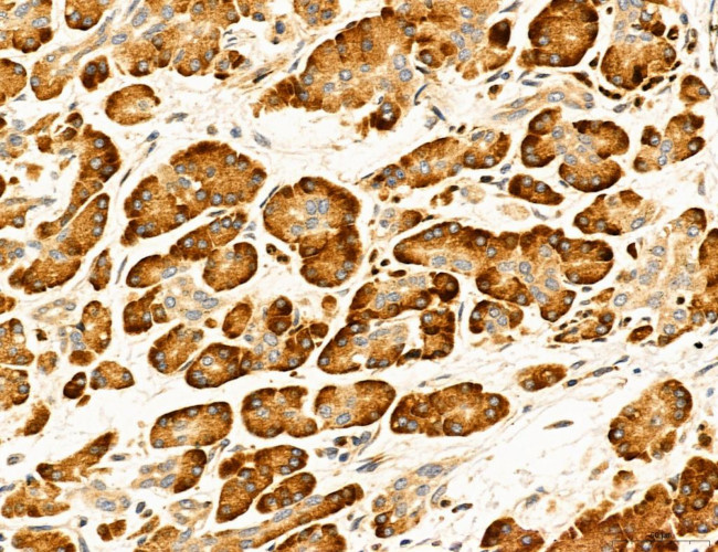 Clathrin Light Chain Antibody in Immunohistochemistry (Paraffin) (IHC (P))