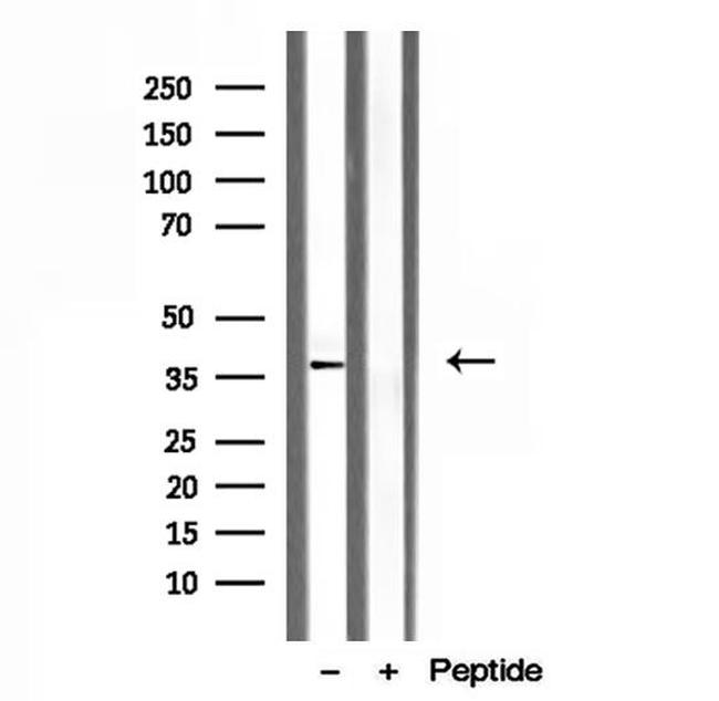 Clathrin Light Chain Antibody in Western Blot (WB)