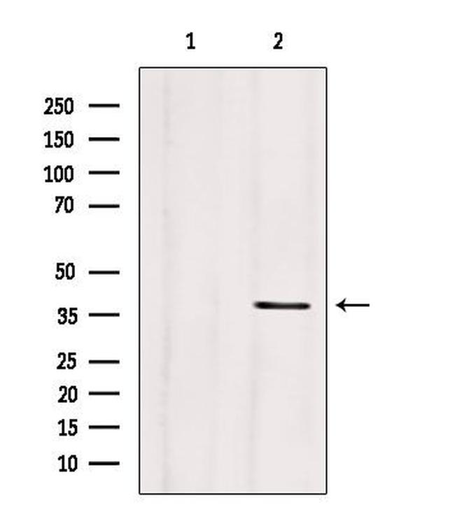 Clathrin Light Chain Antibody in Western Blot (WB)