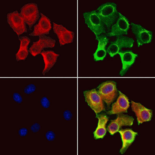 IFT25 Antibody in Immunocytochemistry (ICC/IF)