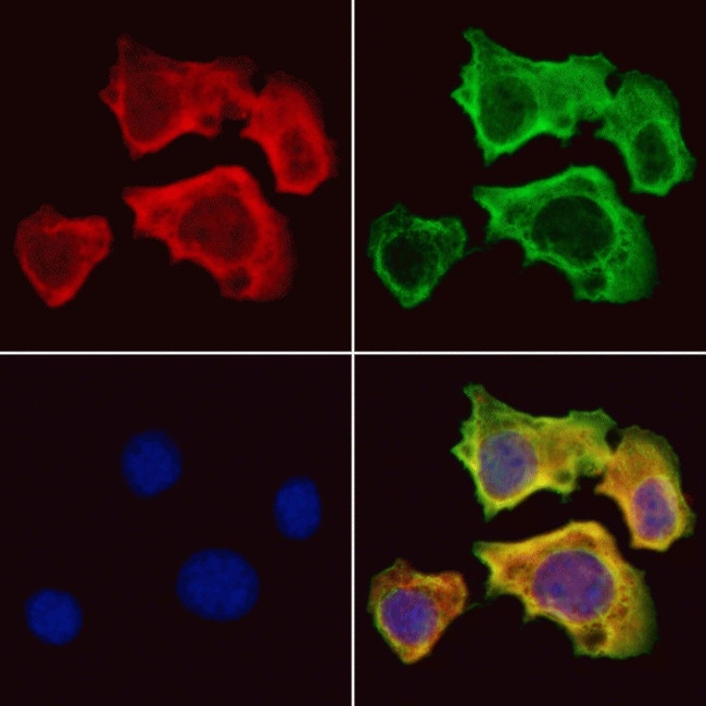 ISCU Antibody in Immunocytochemistry (ICC/IF)