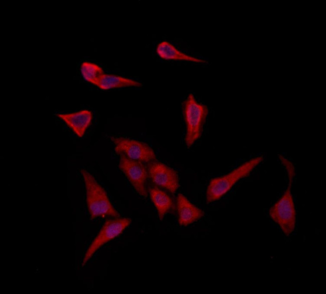 ISCU Antibody in Immunocytochemistry (ICC/IF)