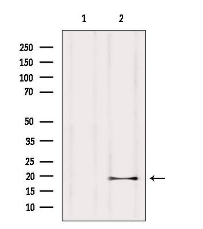 ISCU Antibody in Western Blot (WB)