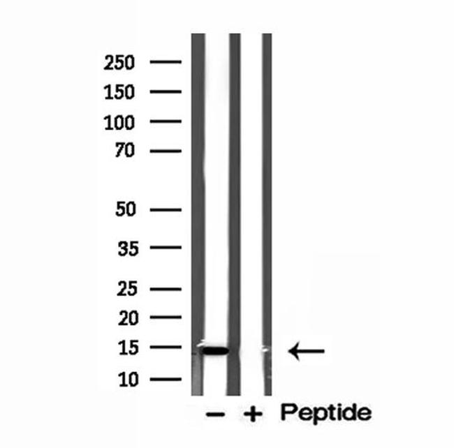 ISCU Antibody in Western Blot (WB)