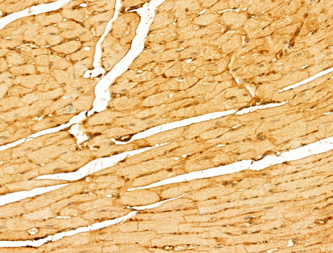 LMOD1 Antibody in Immunohistochemistry (Paraffin) (IHC (P))