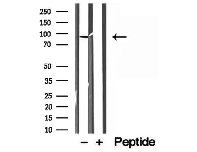 LMOD1 Antibody in Western Blot (WB)