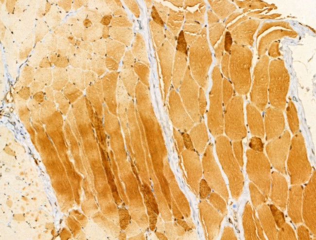 Melanophilin Antibody in Immunohistochemistry (Paraffin) (IHC (P))