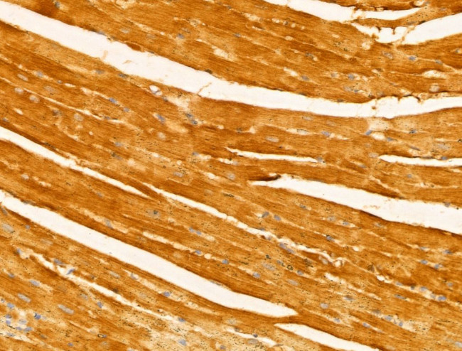 Melanophilin Antibody in Immunohistochemistry (Paraffin) (IHC (P))