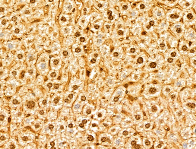 NUDT21 Antibody in Immunohistochemistry (Paraffin) (IHC (P))