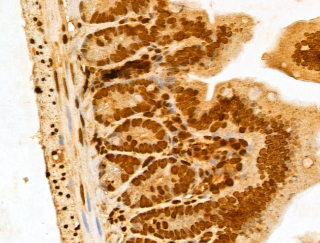 NUDT21 Antibody in Immunohistochemistry (Paraffin) (IHC (P))