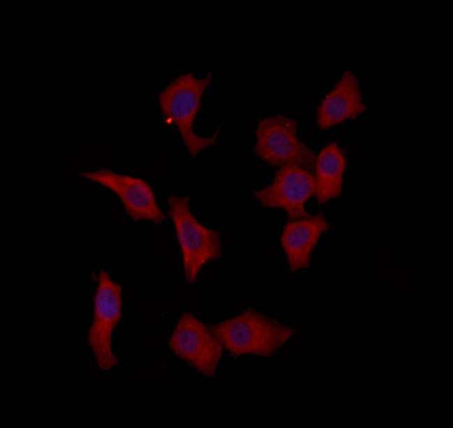 PTPN23 Antibody in Immunocytochemistry (ICC/IF)