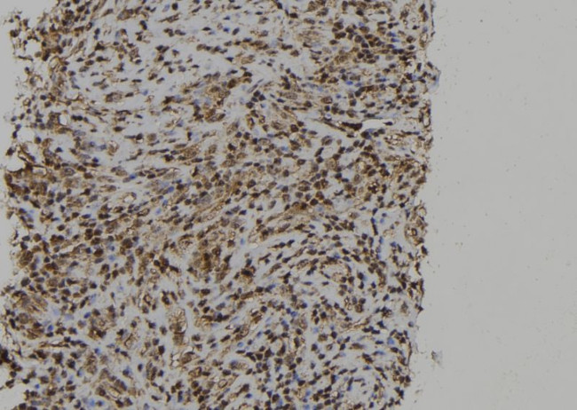 PTPN23 Antibody in Immunohistochemistry (Paraffin) (IHC (P))