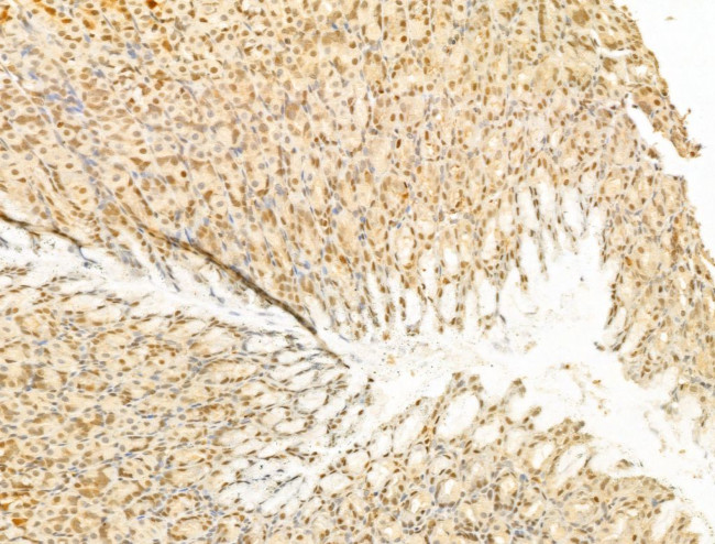 PTPN23 Antibody in Immunohistochemistry (Paraffin) (IHC (P))